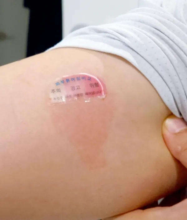 알쓰패치 실사용 후기 — 음주체질이 궁금하다면 알쓰패치!
